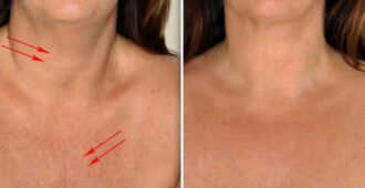 Применяй эти 4 ингредиента и кожа шеи и декольте будет, как в 20 лет! - Твой интернет